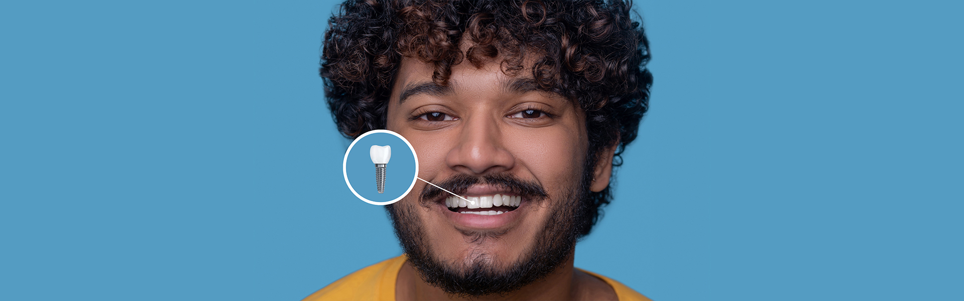 How Long Do Dental Implants Last? Factors That Affect Their Success